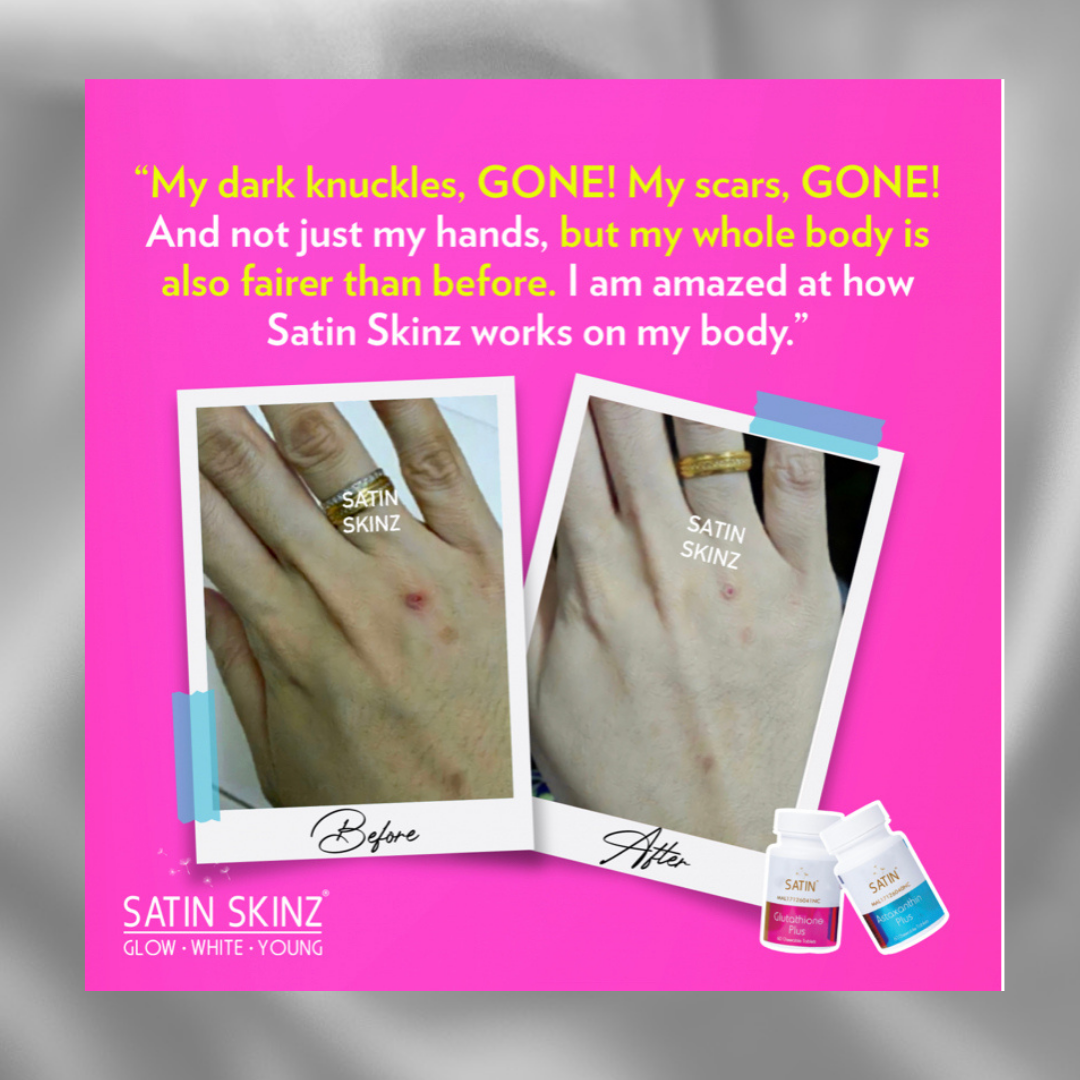 SATIN SKIN GLUTA TABS  Glowqueenskin